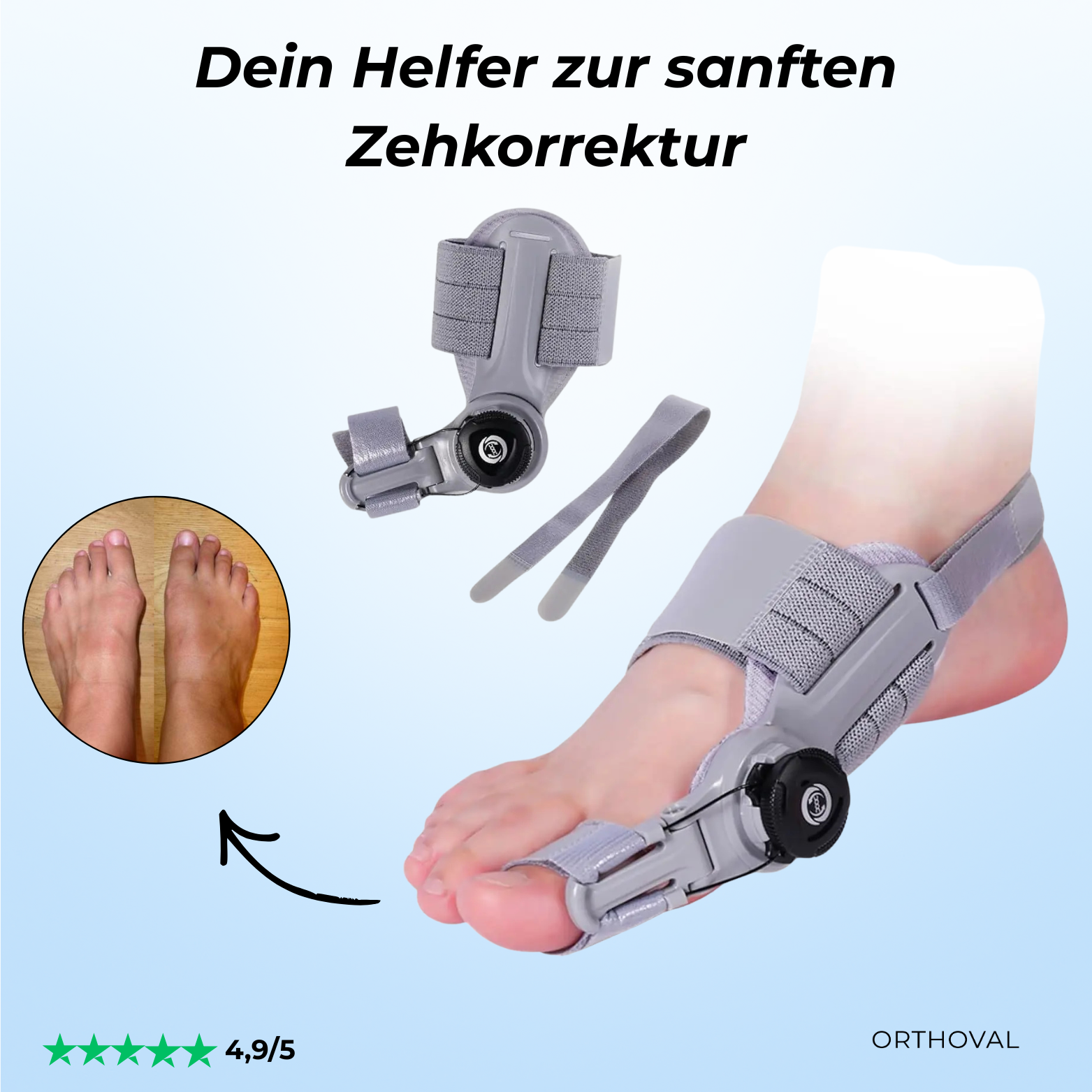 Attelle Orthoval pour correction des orteils