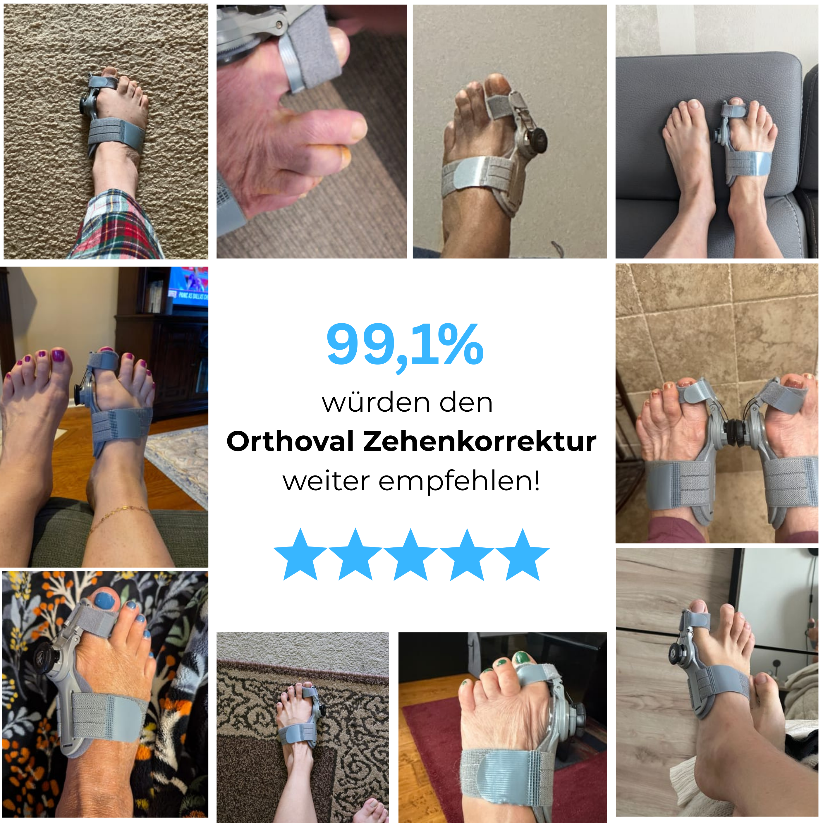 Attelle Orthoval pour correction des orteils